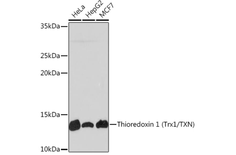 Western Blot - Anti-Thioredoxin/TRX Antibody [ARC2658] (A305563) - Antibodies.com