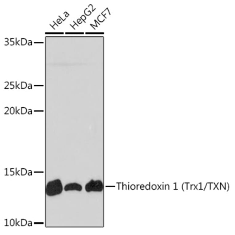 Western Blot - Anti-Thioredoxin/TRX Antibody [ARC2658] (A305563) - Antibodies.com