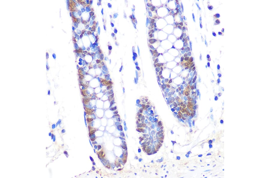 Immunohistochemistry - Anti-Thioredoxin/TRX Antibody [ARC2658] (A305563) - Antibodies.com