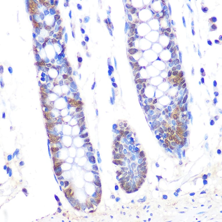 Immunohistochemistry - Anti-Thioredoxin/TRX Antibody [ARC2658] (A305563) - Antibodies.com