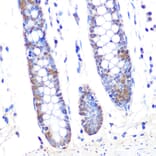 Immunohistochemistry - Anti-Thioredoxin/TRX Antibody [ARC2658] (A305563) - Antibodies.com