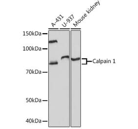 Western Blot - Anti-Calpain 1 Antibody [ARC1272] (A305565) - Antibodies.com