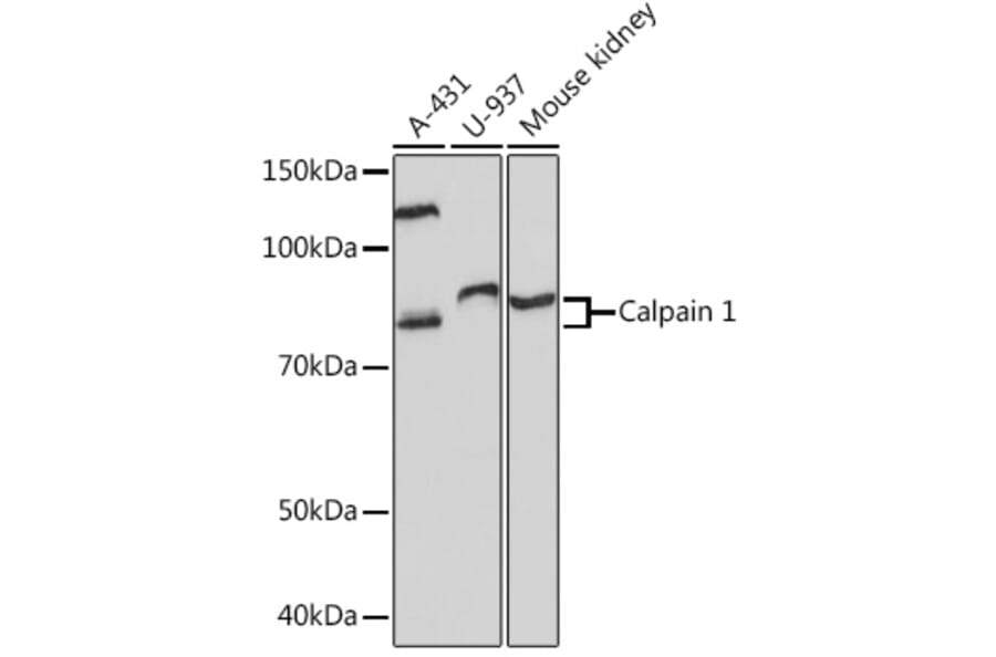 Western Blot - Anti-Calpain 1 Antibody [ARC1272] (A305565) - Antibodies.com