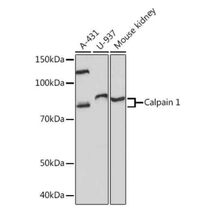 Western Blot - Anti-Calpain 1 Antibody [ARC1272] (A305565) - Antibodies.com