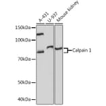 Western Blot - Anti-Calpain 1 Antibody [ARC1272] (A305565) - Antibodies.com