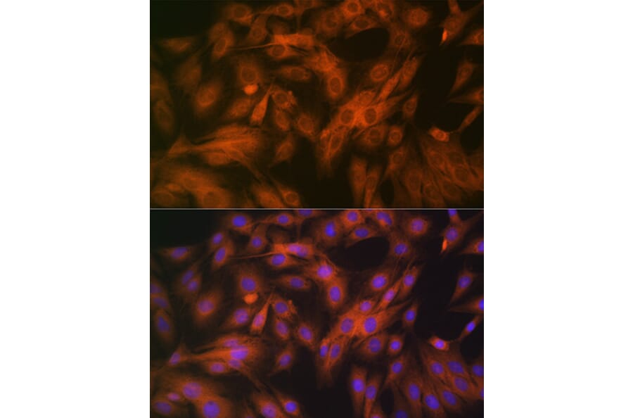 Immunofluorescence - Anti-Calpain 1 Antibody [ARC1272] (A305565) - Antibodies.com