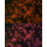 Immunofluorescence - Anti-Calpain 1 Antibody [ARC1272] (A305565) - Antibodies.com