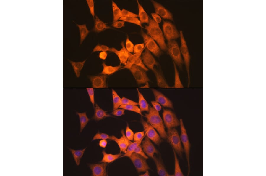 Immunofluorescence - Anti-Calpain 1 Antibody [ARC1272] (A305565) - Antibodies.com