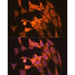 Immunofluorescence - Anti-Calpain 1 Antibody [ARC1272] (A305565) - Antibodies.com