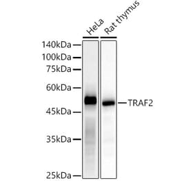 Western Blot - Anti-TRAF2 Antibody [ARC51292] (A305567) - Antibodies.com