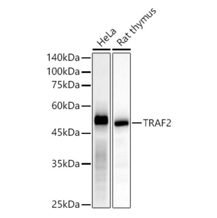 Western Blot - Anti-TRAF2 Antibody [ARC51292] (A305567) - Antibodies.com