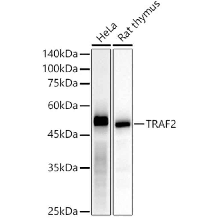 Western Blot - Anti-TRAF2 Antibody [ARC51292] (A305567) - Antibodies.com