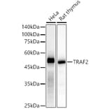 Western Blot - Anti-TRAF2 Antibody [ARC51292] (A305567) - Antibodies.com