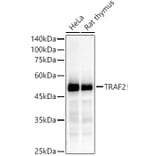 Western Blot - Anti-TRAF2 Antibody [ARC51292] (A305567) - Antibodies.com
