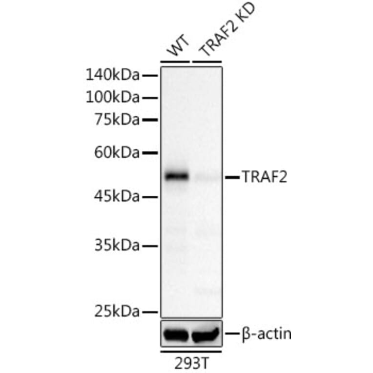 Western Blot - Anti-TRAF2 Antibody [ARC51292] (A305567) - Antibodies.com