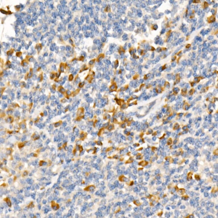 Immunohistochemistry - Anti-TRAF2 Antibody [ARC51292] (A305567) - Antibodies.com