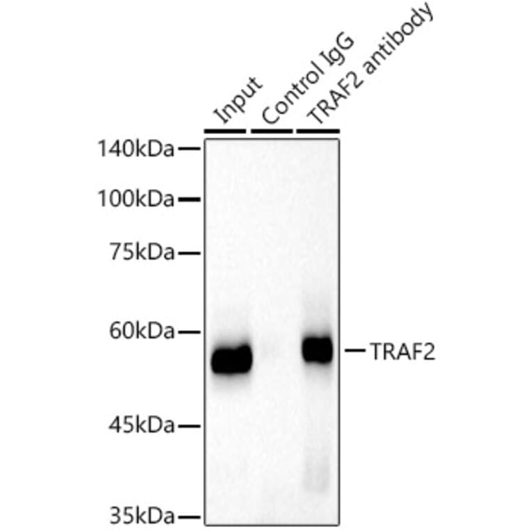 Western Blot - Anti-TRAF2 Antibody [ARC51292] (A305567) - Antibodies.com