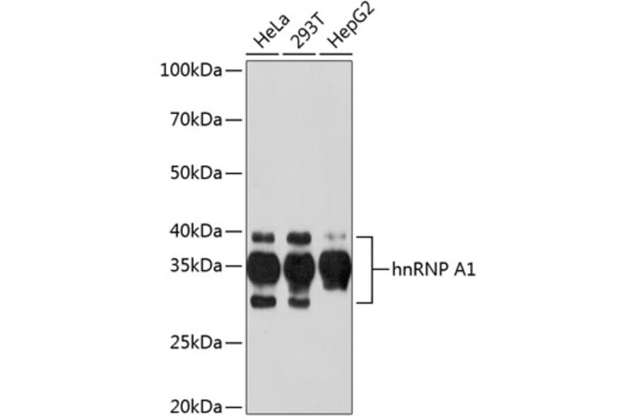 Western Blot - Anti-hnRNP A1 Antibody [ARC0633] (A305568) - Antibodies.com