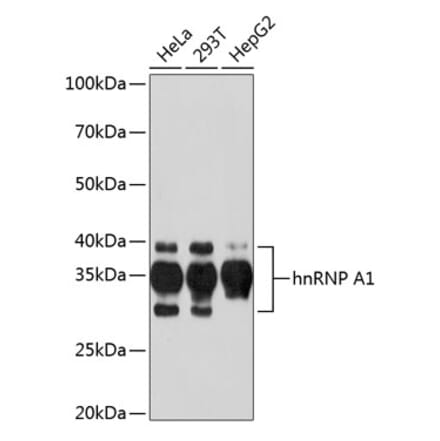 Western Blot - Anti-hnRNP A1 Antibody [ARC0633] (A305568) - Antibodies.com