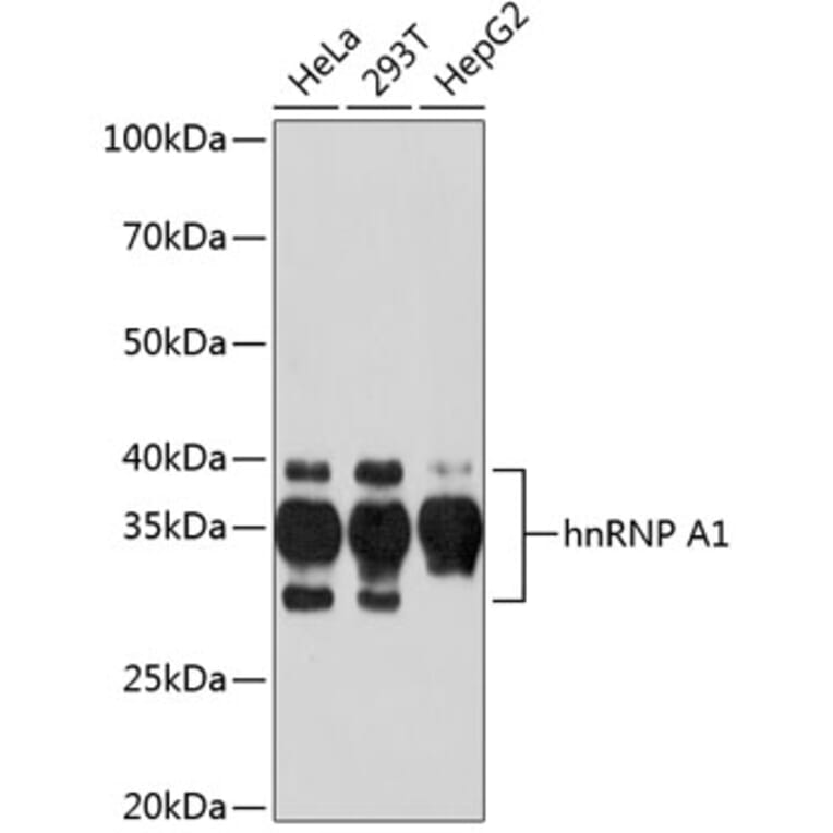 Western Blot - Anti-hnRNP A1 Antibody [ARC0633] (A305568) - Antibodies.com