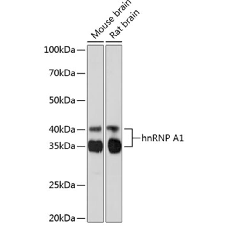 Western Blot - Anti-hnRNP A1 Antibody [ARC0633] (A305568) - Antibodies.com
