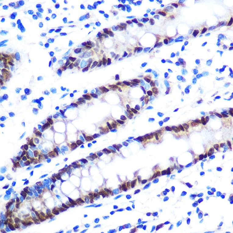 Immunohistochemistry - Anti-hnRNP A1 Antibody [ARC0633] (A305568) - Antibodies.com