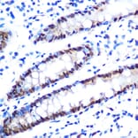 Immunohistochemistry - Anti-hnRNP A1 Antibody [ARC0633] (A305568) - Antibodies.com