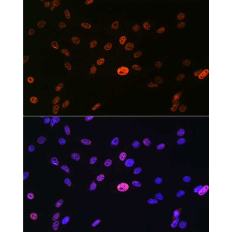 Immunofluorescence - Anti-hnRNP A1 Antibody [ARC0633] (A305568) - Antibodies.com