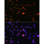 Immunofluorescence - Anti-hnRNP A1 Antibody [ARC0633] (A305568) - Antibodies.com