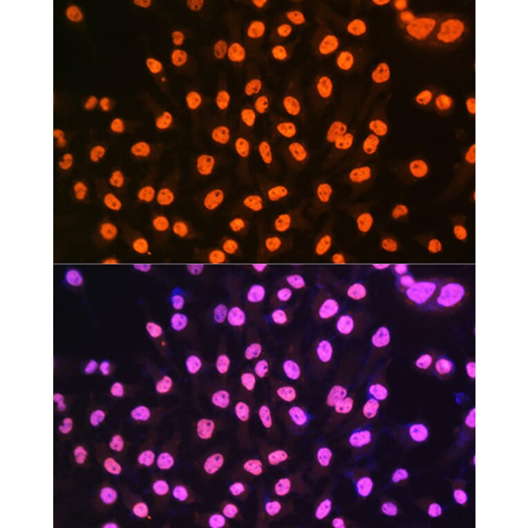 Immunofluorescence - Anti-hnRNP A1 Antibody [ARC0633] (A305568) - Antibodies.com