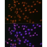 Immunofluorescence - Anti-hnRNP A1 Antibody [ARC0633] (A305568) - Antibodies.com