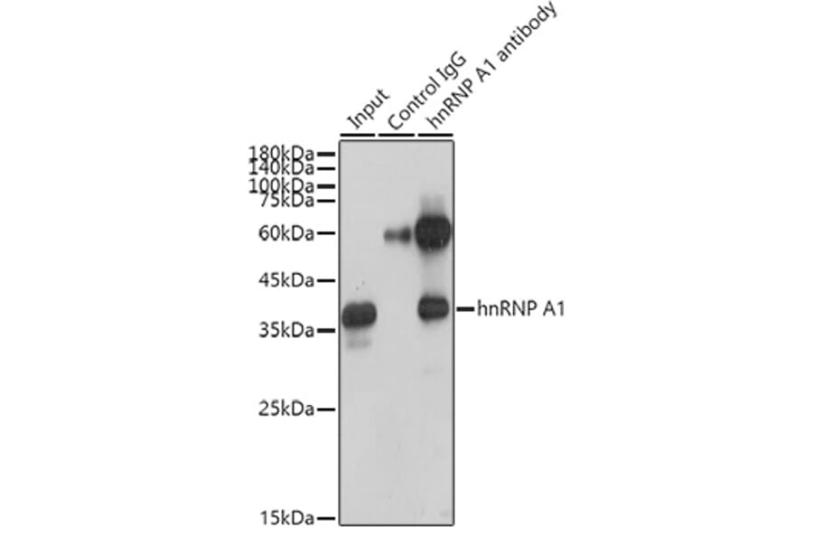 Western Blot - Anti-hnRNP A1 Antibody [ARC0633] (A305568) - Antibodies.com