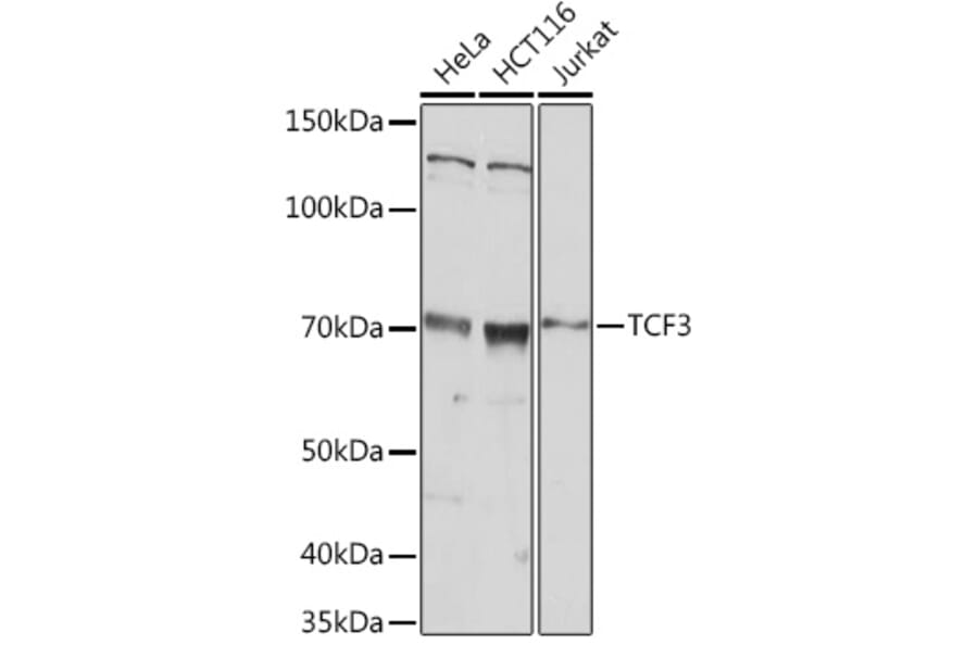 Western Blot - Anti-TCF3/E2A Antibody (A305569) - Antibodies.com