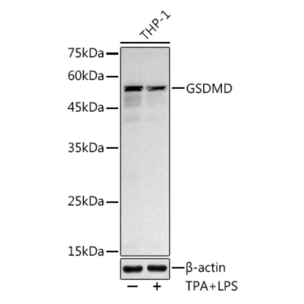 Western Blot - Anti-GSDMD Antibody [ARC50993] (A305571) - Antibodies.com