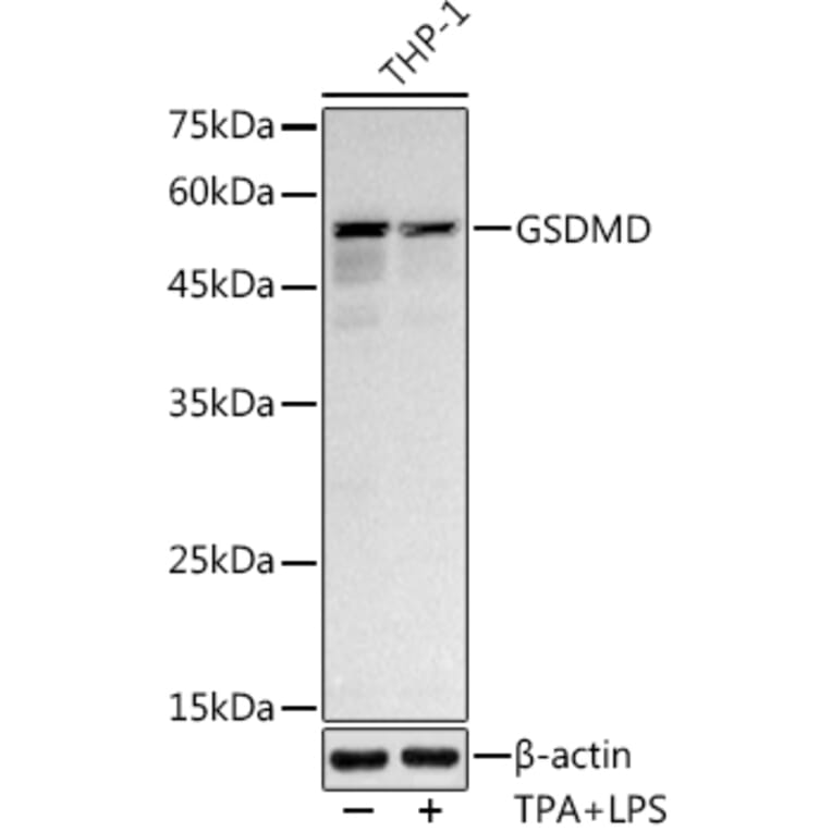 Western Blot - Anti-GSDMD Antibody [ARC50993] (A305571) - Antibodies.com