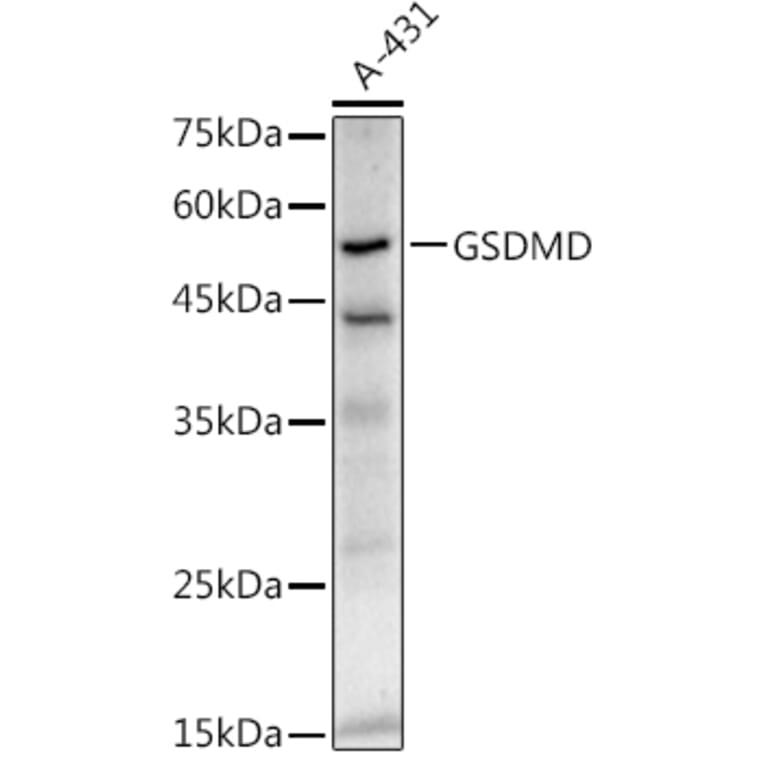 Western Blot - Anti-GSDMD Antibody [ARC50993] (A305571) - Antibodies.com