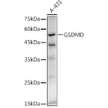 Western Blot - Anti-GSDMD Antibody [ARC50993] (A305571) - Antibodies.com