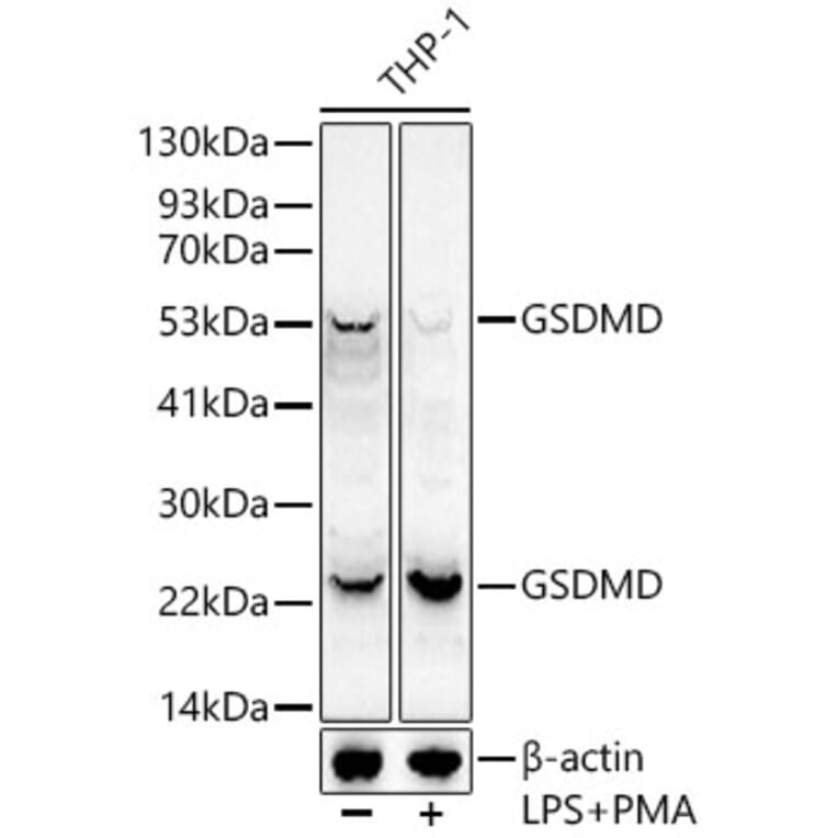 Western Blot - Anti-GSDMD Antibody [ARC50993] (A305571) - Antibodies.com