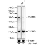 Western Blot - Anti-GSDMD Antibody [ARC50993] (A305571) - Antibodies.com