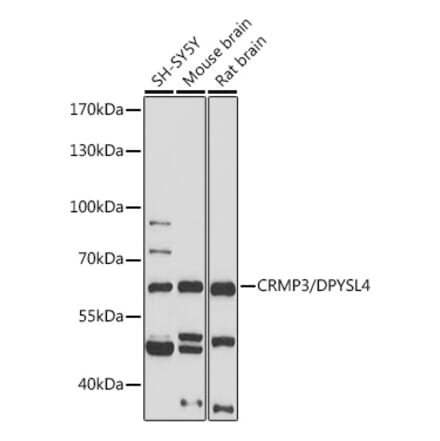 Western Blot - Anti-CRMP3 Antibody (A305573) - Antibodies.com