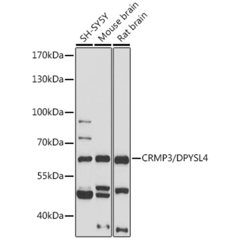 Western Blot - Anti-CRMP3 Antibody (A305573) - Antibodies.com