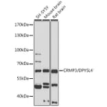 Western Blot - Anti-CRMP3 Antibody (A305573) - Antibodies.com