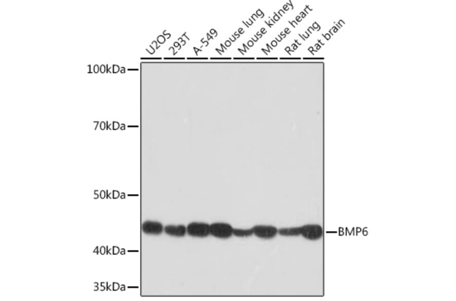 Western Blot - Anti-BMP6 Antibody [ARC1025] (A305574) - Antibodies.com