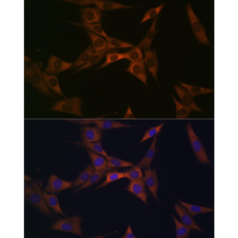 Immunofluorescence - Anti-BMP6 Antibody [ARC1025] (A305574) - Antibodies.com