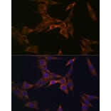 Immunofluorescence - Anti-BMP6 Antibody [ARC1025] (A305574) - Antibodies.com