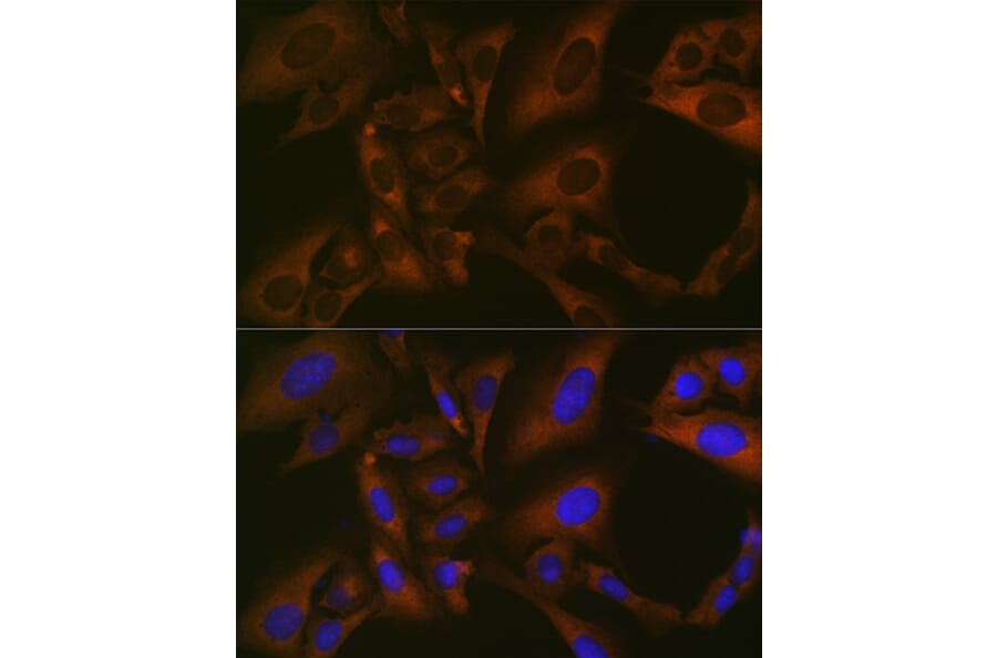 Immunofluorescence - Anti-BMP6 Antibody [ARC1025] (A305574) - Antibodies.com