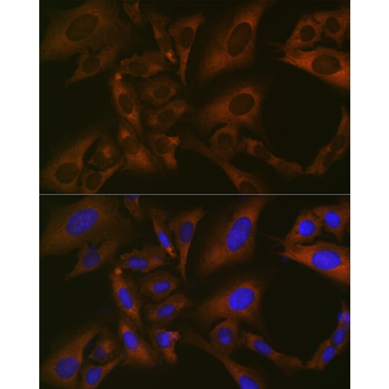 Immunofluorescence - Anti-BMP6 Antibody [ARC1025] (A305574) - Antibodies.com