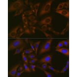 Immunofluorescence - Anti-BMP6 Antibody [ARC1025] (A305574) - Antibodies.com