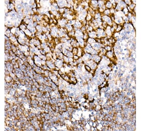 Immunohistochemistry - Anti-CD35 Antibody [ARC2065] (A305576) - Antibodies.com