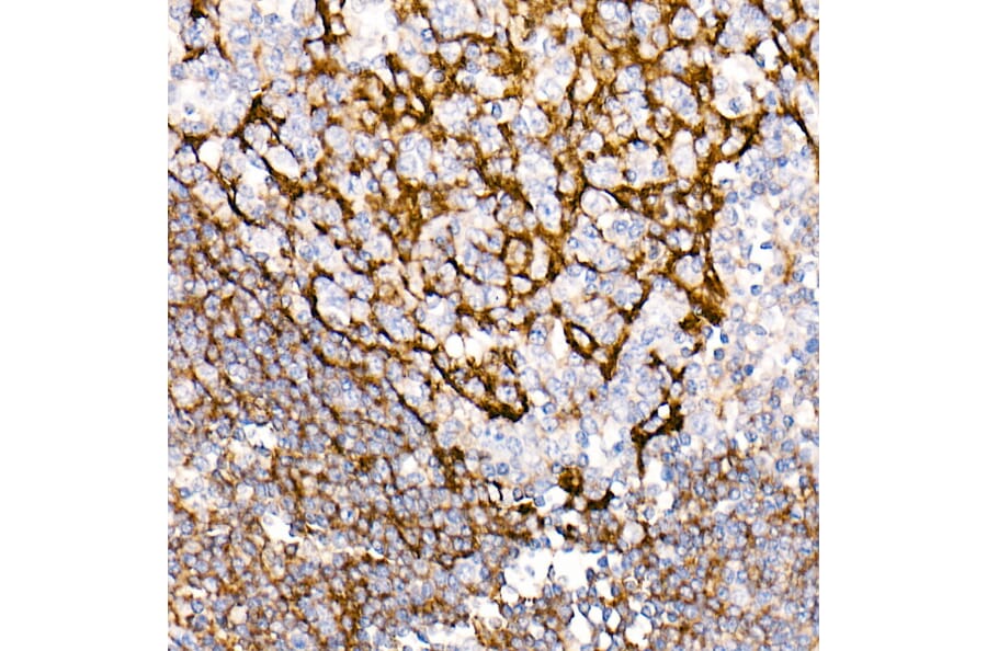 Immunohistochemistry - Anti-CD35 Antibody [ARC2065] (A305576) - Antibodies.com